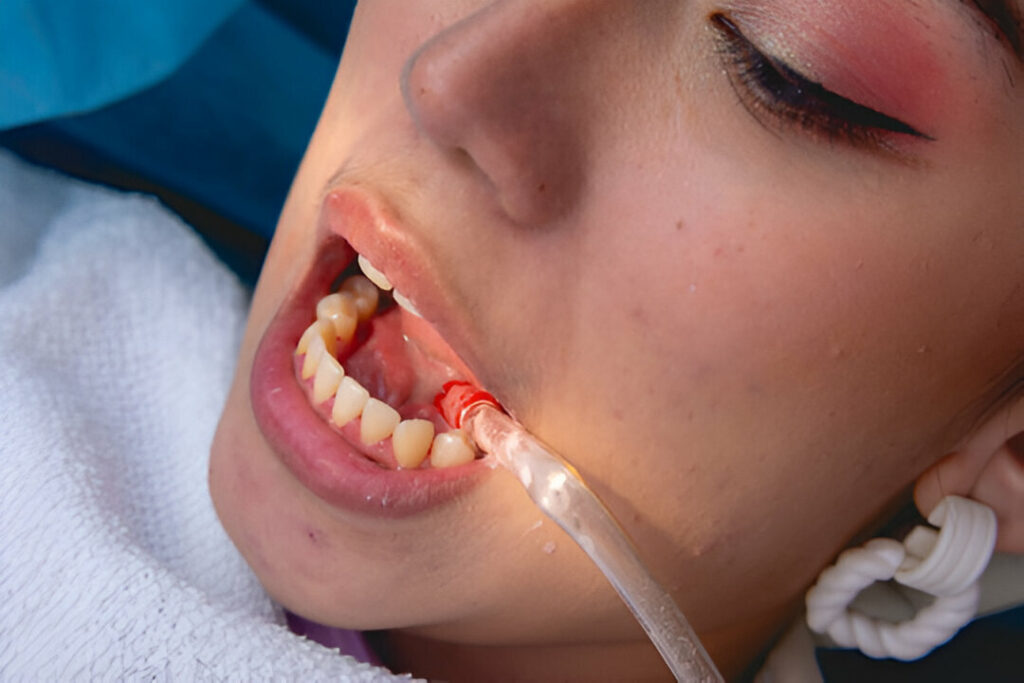 The effect of Poor Dental Health on Your Body