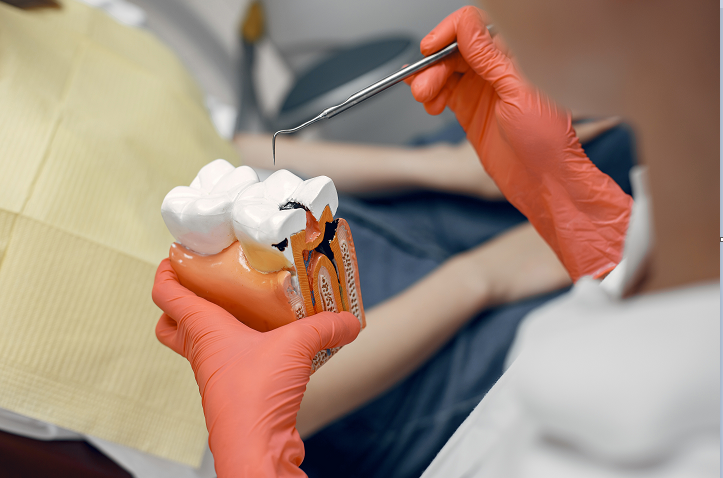 The Risks of Delaying Root Canal Treatment